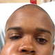 Illustration for article titled This Is What A 90-MPH Fastball To The Face Looks Like